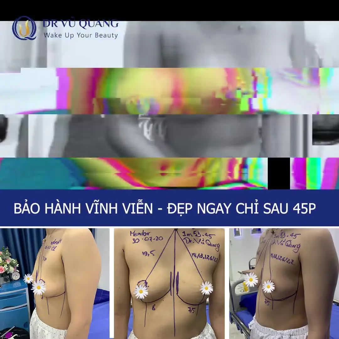 Hình 41 trong bộ gái ngực to